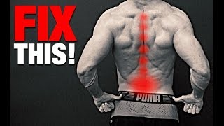 How to Fix a Bulging Disc NO SURGERY [upl. by Nasia]