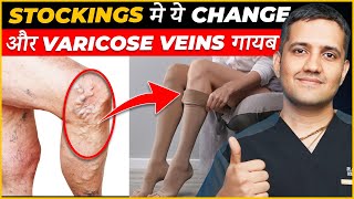 Stockings for varicose veins  Varicose veins treatment without surgery  Dr Gaurav Gangwani [upl. by Adyht]