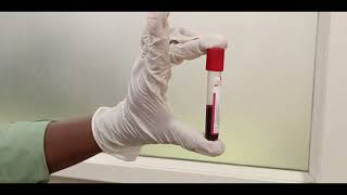 Blood Collection Tubes  Order of vials [upl. by Zelde]