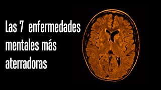 Las 7 enfermedades mentales más aterradoras [upl. by Sherar]