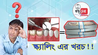 dental scaling costদাঁত স্কেলিং এর খরচdrashiquzzaman shantoস্বাস্থ্যসেবা [upl. by Bickart410]