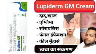 मात्र 5 दिन मे दाद खाज खुजली जड़ खत्म ।। dad khaj khujali ki dava ।। lupiderm gm cream uses Hindi [upl. by Hakon]