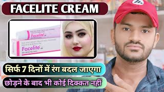 Facelite cream uses dose benefits and Side effects full review in hindi [upl. by Eceirtal814]