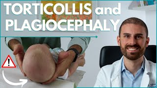 How to TREAT BABY TORTICOLLIS and PLAGIOCEPHALY  Dr Matteo Silva Pediatric Osteopath [upl. by Aiht]