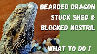 Bearded dragon stuck shed amp blocked nostril and how to treat it [upl. by Liuka]