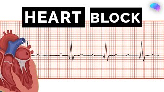 Heart Block  AV Block  ECG  EKG  OSCE Guide  UKMLA  CPSA [upl. by Lonni393]