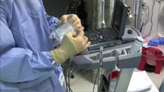 Sterile Sheath for Ultrasound Guided Procedure Single Operator Technique [upl. by Cinderella]