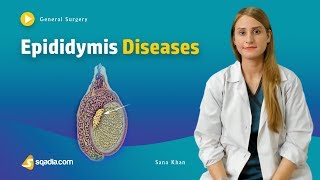 Epididymis Diseases  Surgery Video Lecture  Medical Online Education  VLearning™ [upl. by Roach]