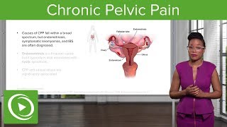 Chronic Pelvic Pain CPP Definition Diagnosis amp Management – Gynecology  Lecturio [upl. by Dranyar]