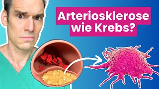 Arteriosklerose  eine tumorartige Erkrankung  Dr Waller erklärt [upl. by Hairabez203]