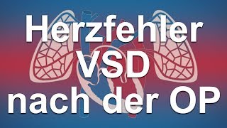 Herzfehler einfach erklärt  Ventrikelseptumdefekt VSD Funktion des Herzens nach der OP [upl. by Anthiathia]