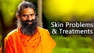 Skin Problems amp Treatments  Swami Ramdev [upl. by Emmott881]