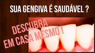 Como saber se a GENGIVA está SAUDÁVEL DESCUBRA EM CASA [upl. by Ateinotna63]