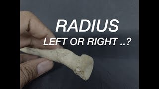 RADIUS  SIDE DETERMINATION [upl. by Gibby]