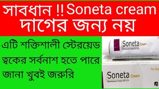 Mukher kalo dag dur korar upay  soneta cream এর কাজ কি অপকারিতা প্বার্শ প্রতিক্রিয়া সতর্কতা। [upl. by Keldah]