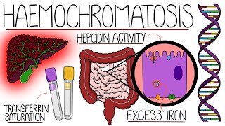 Understanding Haemochromatosis Hereditary amp Secondary [upl. by Anaik523]