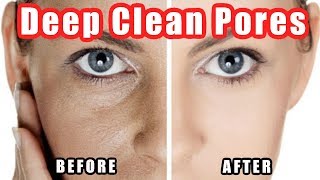 How to Clean Pores  Deep Cleaning Your Pores on Nose  Face Easily [upl. by Akiwak]