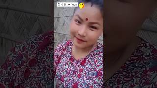 Accident 2nd time aayega😁😂 trendingfunnyjokescomedy contentviralshortvideosAngelHanse Baby [upl. by Ahusoj230]