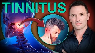 TINNITUS por problemas CERVICALES Alivia y elimina con estos TIPS [upl. by O'Connor]