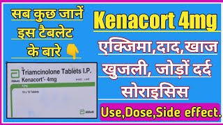 Triamcinolone। Kenacort 4mg Tablet Review।Use। Dose। Side effect। Precaution। हिंदी में। medicine [upl. by Waldack241]