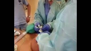 Airway Management During a Difficult Intubation Case [upl. by Ardelle]