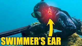 Swimmers Ear Otitis Externa Prevention  DIY Solution For Divers [upl. by Zebadiah]