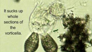 heliozoan food vacuole attacked by coleps [upl. by Hershell]