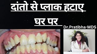 Daanto Se Plaque Ko Ghar Pe Saaf Kese Kare  दांतों से प्लाक और टार्टर हटाने ki Home Remedies [upl. by Stahl]