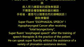 史上超強：「食道語」super fluent Esophageal Speech hypopharyngeal cancer after total laryngectomy [upl. by Senhauser]