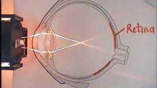 The Eye Focus and Optical Lens [upl. by Lumbard]