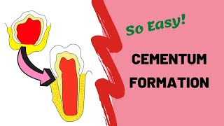 What is Cementum [upl. by Orv]