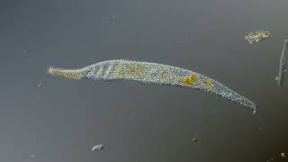 Interstitial Ciliates  Jaffa port [upl. by Burman]