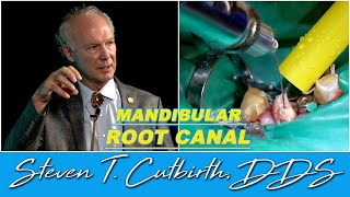 Mandibular Cuspid Root Canal  Dental Minute with Steven T Cutbirth DDS [upl. by Anoo]