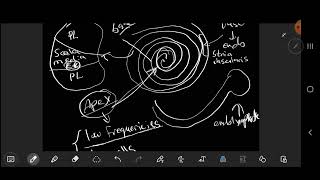 Otolaryngology  ENT  Menieres disease [upl. by Flemming]