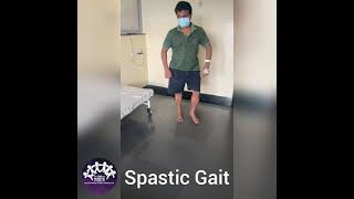 SPASTIC GAIT [upl. by Persian]