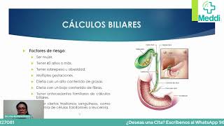 Cálculos a la Vesícula Biliar ¿Se pueden eliminar sin cirugía [upl. by Sillert]