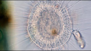 Rotifer Tangled Up with a Heliozoan [upl. by Odlo]