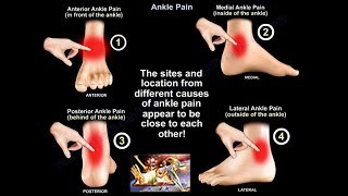 Ankle Pain  Everything You Need To Know  Dr Nabil Ebraheim [upl. by Helena794]