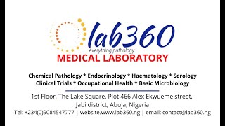 Rheumatoid Factor test from LAB360 Medical Laboratory [upl. by Sirrah505]