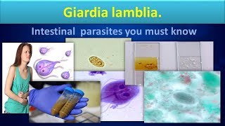 Giardia lambliaLife cycleStructureLabdiagnosisGiardiasisClear overview [upl. by Belinda247]