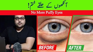 Dr ZeeHow to Get Rid of Puffy Eyes and Dark Circles  डॉक्टर ज़ी [upl. by Miche]