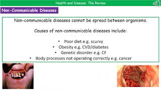 OCR Gateway A B631  Health and Disease [upl. by Boar]