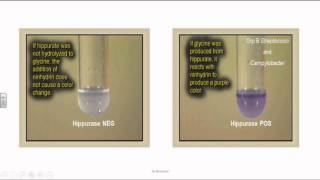 Group B Streptococci or Streptococcus Agalactia [upl. by Bascio]