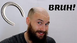 2 YEARS OF BALDING IN 2 MINUTES  Going Bald Fast Horse shoe [upl. by Eelahs]