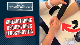 Kinesiotaping Technique for Treatment of DeQuervains Tenosynovitis  Technique Peek Series [upl. by Sitoel630]