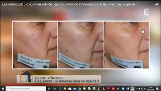 La lumière LED  le nouveau soin de beauté sur France 2 Vergetures Acné cicatrices alopécie [upl. by Ajup668]