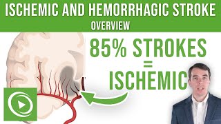 Overview of Ischemic and Hemorrhagic Stroke  Lecturio [upl. by Tehr126]