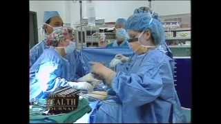 Laparoscopic Hysterectomy Surgery [upl. by Shanta]