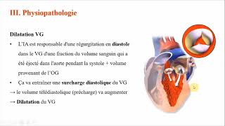 07 Insuffisance aortique Dr MSLounes  Cardio [upl. by Bliss]