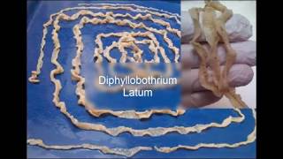 Diphyllobothrium latum [upl. by Atrice668]